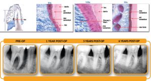 Gum Disease Treatment