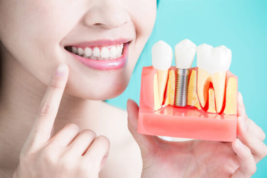 Woman smiling while displaying tooth implant modal.